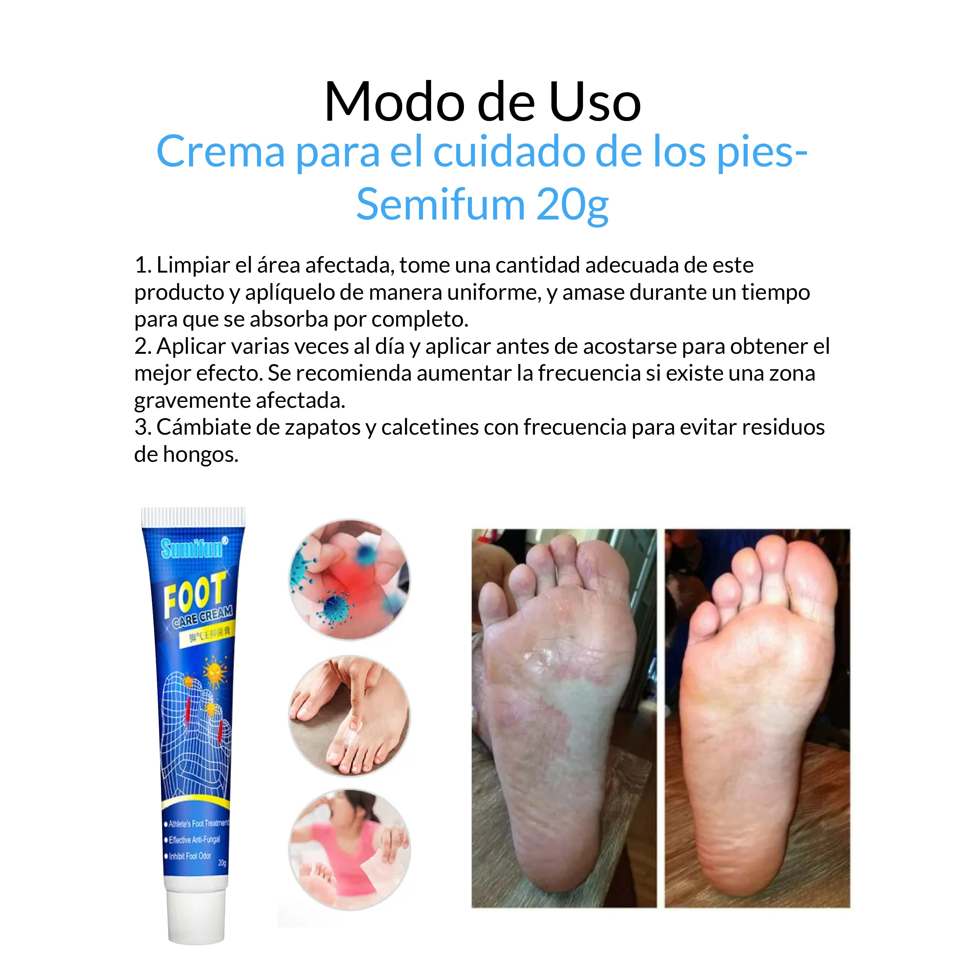 Crema Antihongos Para Pies de Atleta - Semifun 20g