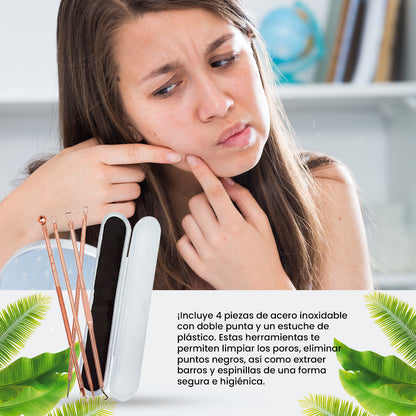 FLOWER SECRET – EXTRACCIÓN DE ACNÉ Y PUNTOS NEGROS – SET EXTRACTOR DE ACNÉ – 4 PIEZAS