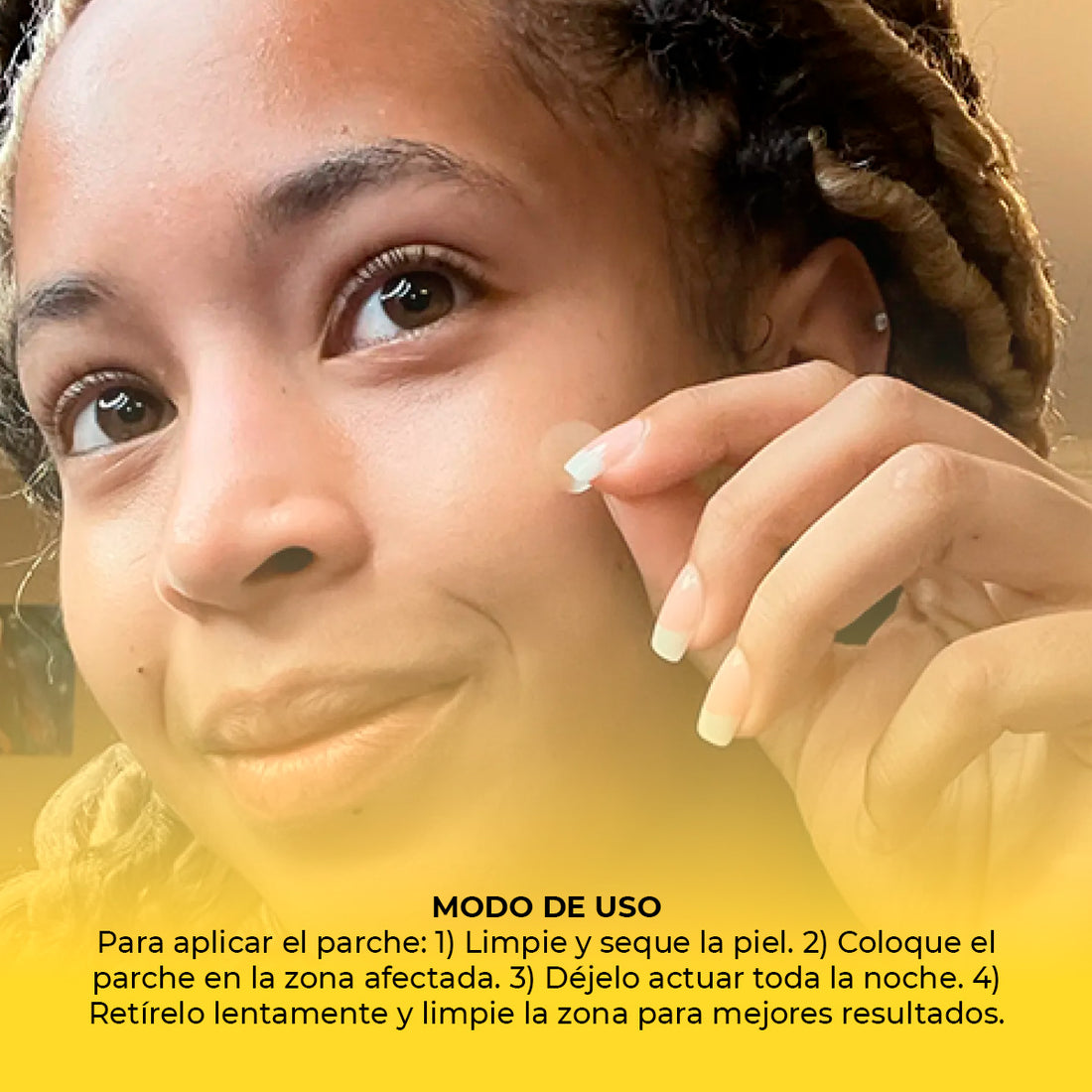 Parches para el acné 40 Unidades Panoxyl PM