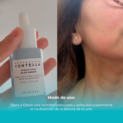 Madagascar Centella Hyalu-Cica Blue Serum 30ml SKIN1004